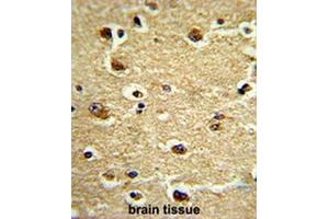 Formalin-fixed and paraffin-embedded human brain tissue reacted with CROT Antibody (N-term), which was peroxidase-conjugated to the secondary antibody, followed by DAB staining. (CROT antibody  (N-Term))