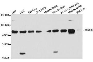 Western blot analysis of extracts of various cell lines, using MOGS antibody. (GCS1 antibody)