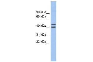 FBXL14 antibody used at 1 ug/ml to detect target protein. (FBXL14 antibody  (N-Term))