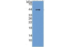 WB of Protein Standard: different control antibodies against Highly purified E. (Complement Factor H ELISA Kit)