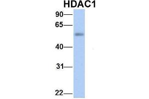 Host:  Rabbit  Target Name:  HDAC1  Sample Type:  Human Fetal Lung  Antibody Dilution:  1.