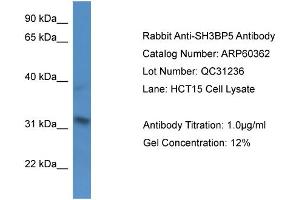 Western Blotting (WB) image for anti-SH3-Domain Binding Protein 5 (SH3BP5) (N-Term) antibody (ABIN2788423) (SH3BP5 antibody  (N-Term))