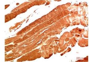 Immunohistochemical analysis of paraffin-embedded Human Skeletal Muscle Tissue using NBR1 Mouse mAb diluted at 1:200. (NBR1 antibody)