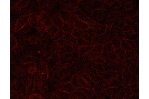 E-cadherin for IHC in human HepG2,Provided by Tianjin University (E-cadherin antibody  (C-Term))