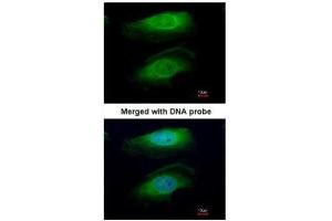 ICC/IF Image Immunofluorescence analysis of paraformaldehyde-fixed HeLa, using RICTOR, antibody at 1:200 dilution. (RICTOR antibody  (C-Term))