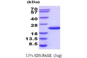 SDS-PAGE (SDS) image for Ubiquitin-Conjugating Enzyme E2G 2 (UBE2G2) (AA 1-165) protein (His tag) (ABIN5854278)