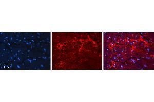 Rabbit Anti-ACP1 Antibody   Formalin Fixed Paraffin Embedded Tissue: Human heart Tissue Observed Staining: Extracellular Primary Antibody Concentration: N/A Other Working Concentrations: 1:600 Secondary Antibody: Donkey anti-Rabbit-Cy3 Secondary Antibody Concentration: 1:200 Magnification: 20X Exposure Time: 0. (ACP1 antibody  (Middle Region))
