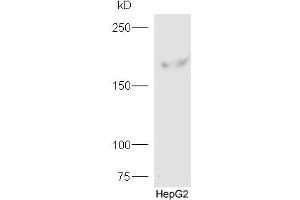 Human HepG2 probed with Rabbit Anti-FYCO1 Polyclonal Antibody, Unconjugated (ABIN1714617) at 1:300 overnight at 4 °C.