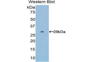Western Blotting (WB) image for anti-UDP-Glucose Glycoprotein Glucosyltransferase 2 (UGT2) (AA 1221-1408) antibody (ABIN1176725) (UGCGL2 antibody  (AA 1221-1408))
