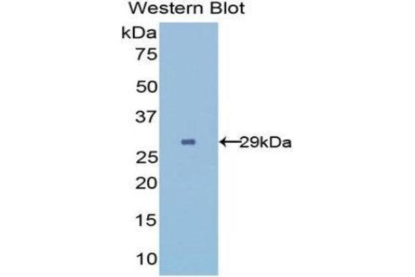 UGCGL2 antibody  (AA 1221-1408)