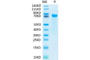 NOTCH2 Protein (His-Avi Tag,Biotin)