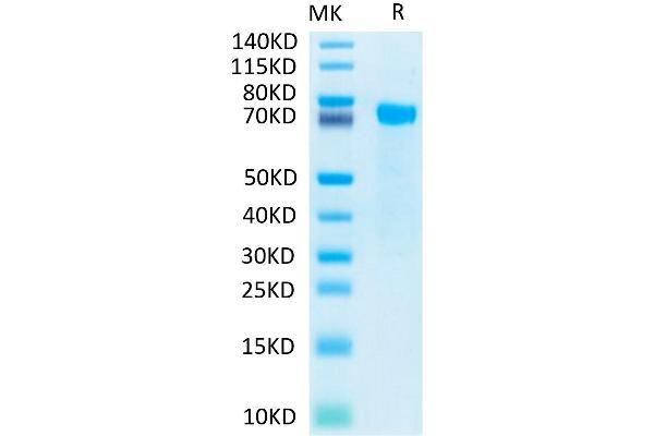 NOTCH2 Protein (His-Avi Tag,Biotin)