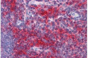 Human Thymus: Formalin-Fixed, Paraffin-Embedded (FFPE) (ADAMTS17 antibody  (AA 543-651))