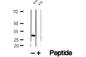 Western blot analysis of extracts of Y79 cells, using ETFA antibody. (ETFA antibody  (Internal Region))