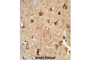 Formalin-fixed and paraffin-embedded human brain tissue reacted with CES7 Antibody (Center), which was peroxidase-conjugated to the secondary antibody, followed by DAB staining. (CES5A antibody  (Middle Region))