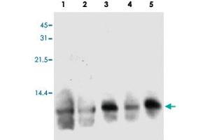 Western blot analysis of human S100A3 in hair extracts from 3 individual female.