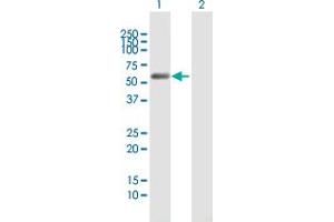 Western Blot analysis of C9orf156 expression in transfected 293T cell line by C9orf156 MaxPab polyclonal antibody. (C9orf156 antibody  (AA 1-441))