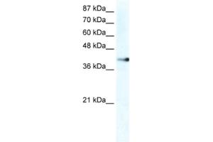 Western Blotting (WB) image for anti-Zinc Finger Protein 556 (ZNF556) antibody (ABIN2461276) (ZNF556 antibody)