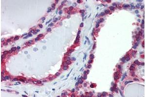 Thyroid, Human: Formalin-Fixed, Paraffin-Embedded (FFPE) (Calnexin antibody)