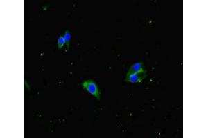 Immunofluorescent analysis of Hela cells using ABIN7153559 at dilution of 1:100 and Alexa Fluor 488-congugated AffiniPure Goat Anti-Rabbit IgG(H+L) (APH1A antibody  (AA 90-118))