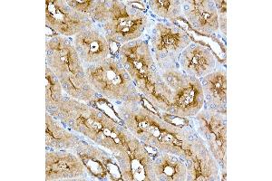 Immunohistochemistry of paraffin-embedded rat kidney using Folate Binding Protein(FBP) / FOLR1 Rabbit mAb (ABIN7267223) at dilution of 1:100 (40x lens). (FOLR1 antibody)