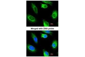 ICC/IF Image Immunofluorescence analysis of paraformaldehyde-fixed HeLa, using glycerol kinase 2, antibody at 1:200 dilution. (GK2 antibody)