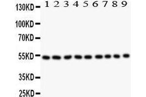 Western Blotting (WB) image for anti-Desmin (DES) (AA 1-304) antibody (ABIN3043265) (Desmin antibody  (AA 1-304))