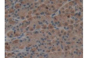 DAB staining on IHC-P; Samples: Rat Stomach Tissue (Epiregulin antibody  (AA 1-162))