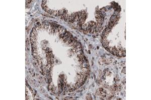Immunohistochemical staining (Formalin-fixed paraffin-embedded sections) of human prostate with CS monoclonal antibody, clone CL2561  shows granular cytoplasmic immunoreactivity in glandular cells. (CS antibody)