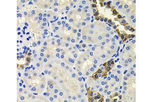 Immunohistochemistry of paraffin-embedded Mouse kidney using CALB2 Polyclonal Antibody at dilution of 1:100 (40x lens). (Calretinin antibody)