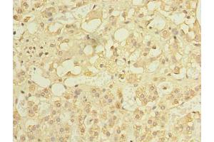 Immunohistochemistry of paraffin-embedded human adrenal gland tissue using ABIN7150185 at dilution of 1: 100