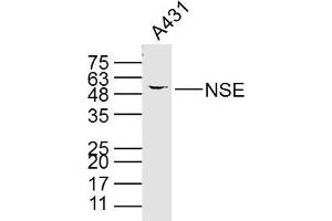A431 cell lysates probed with PNSE (15E2) Monoclonal Antibody, unconjugated (bsm-33072M) at 1:300 overnight at 4°C followed by a conjugated secondary antibody for 60 minutes at 37°C. (ENO2/NSE antibody)