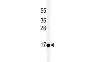 THEM2 antibody western blot analysis in HeLa lysate. (THEM2 antibody)