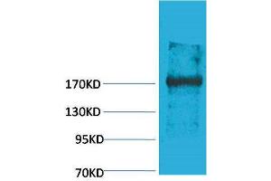 Western Blotting (WB) image for anti-Ectopic P-Granules Autophagy Protein 5 Homolog (EPG5) antibody (ABIN3179041)