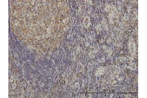 Image no. 2 for anti-Cyclin-Dependent Kinase-Like 4 (CDKL4) (AA 196-295) antibody (ABIN599344) (CDKL4 antibody  (AA 196-295))