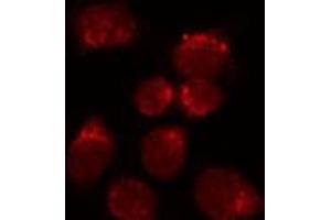 ABIN6272248 staining HuvEc by IF/ICC. (NR2F2 antibody  (N-Term))