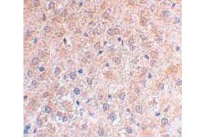 Immunohistochemical staining of mouse liver using TP53INP1 polyclonal antibody  at 2 ug/mL .
