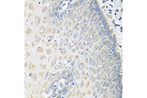 Immunohistochemistry of paraffin-embedded human esophagus using OXCT1 antibody at dilution of 1:100 (40x lens). (OXCT1 antibody)