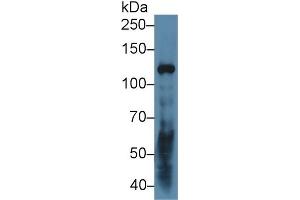 Detection of LAMC2 in Human A431 cell lysate using Polyclonal Antibody to Laminin Gamma 2 (LAMC2)