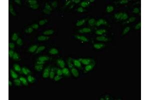 Immunofluorescence (IF) image for anti-Small Nuclear Ribonucleoprotein Polypeptide A (SNRPA) (AA 8-278) antibody (ABIN7174131)