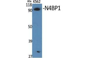 Western Blot (WB) analysis of specific cells using N4BP1 Polyclonal Antibody.