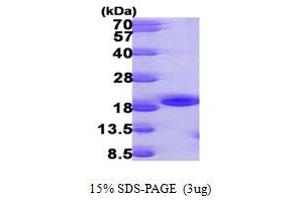 SDS-PAGE (SDS) image for NME/NM23 Nucleoside Diphosphate Kinase 3 (NME3) (AA 22-169) protein (His tag) (ABIN667337) (NME3 Protein (AA 22-169) (His tag))