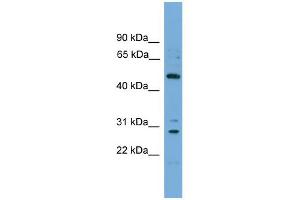 WB Suggested Anti-ULK3 Antibody Titration: 0.