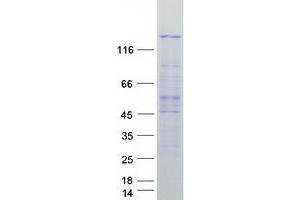 Western Blotting (WB) image for Protein Phosphatase 4, Regulatory Subunit 1 (PPP4R1) (Transcript Variant 2) protein (Myc-DYKDDDDK Tag) (ABIN2729506)
