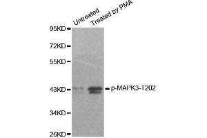 Western blot analysis of extracts from 293 cells, using Phospho-MAPK3-T202 antibody.