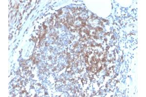 Formalin-fixed, paraffin-embedded human Tonsil stained with CD6 Rabbit Recombinant Monoclonal Antibody (C6/2884R).