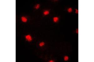 Immunofluorescent analysis of CDC46 staining in HeLa cells. (MCM5 antibody  (N-Term))