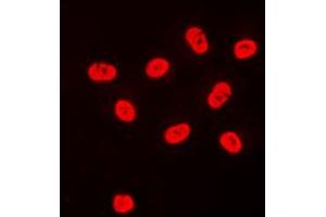 Immunofluorescent analysis of SP3/4 staining in HeLa cells. (Sp3/4 antibody  (C-Term))