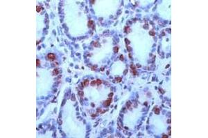 Image no. 1 for anti-Gastrin (GAST) (N-Term) antibody (ABIN373480) (Gastrin antibody  (N-Term))
