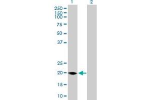 Western Blot analysis of FMO9P expression in transfected 293T cell line by FMO9P MaxPab polyclonal antibody. (FMO9P antibody  (AA 1-160))